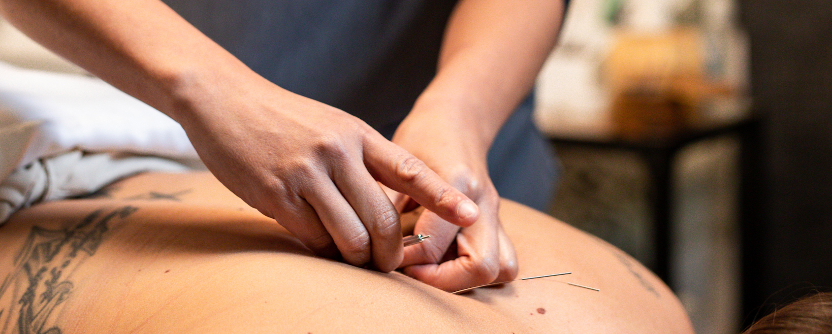 Tradishen Acupuncture, San Diego, CA